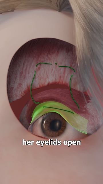 Девочка, которая родилась без способности моргать😳