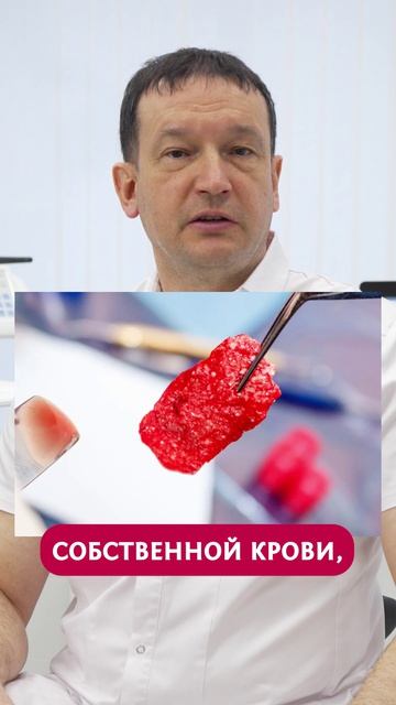 Использовать ПРФ мембрану