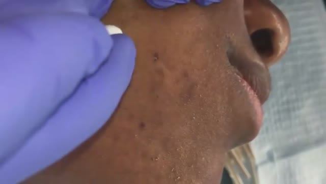 Множественные черные точки