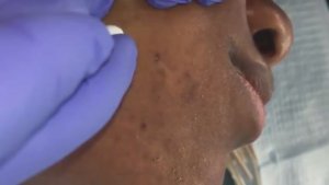 Множественные черные точки