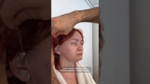 Выполнен комплекс Тотал фейс. Часть 1. Доктор Карапетян