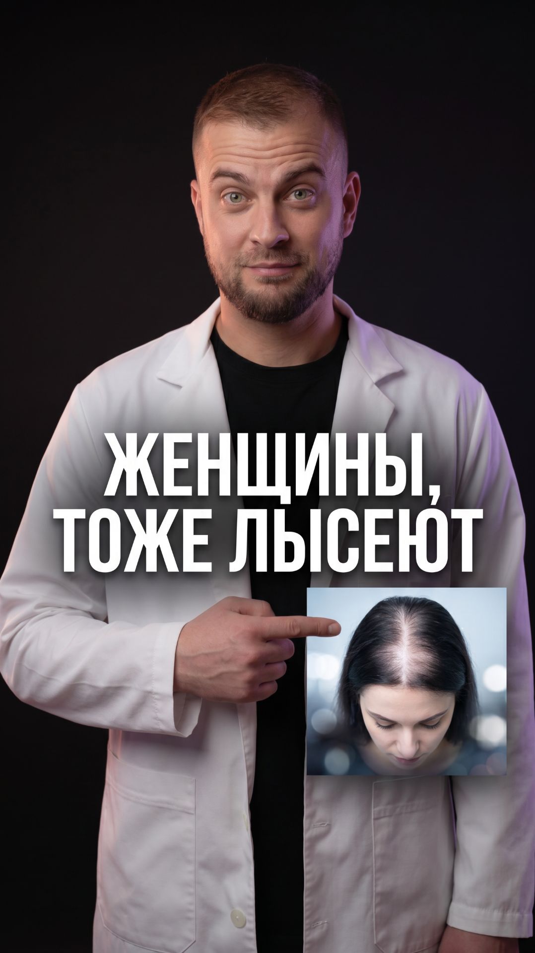 Женщины не лысеют — миф. Разбираем четыре причины женской алопеции