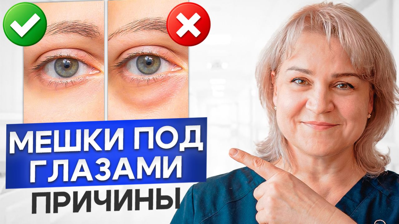 Как убрать ОТЁКИ и МЕШКИ под глазами? Упражнения для лица за 10 минут