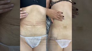 Ошеломляющий результат До/После