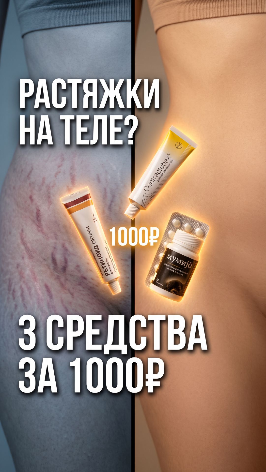 Замучили растяжки — три аптечных средства за 1000 рублей! 😮
