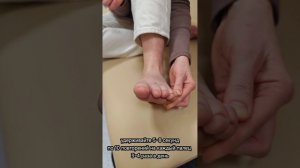 Как разработать стопу после удаления «косточки»? Упражнения по этапам