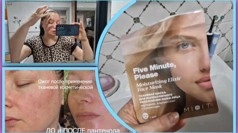 Как всё произошло, рассказываю пока готовлю. Ожог лица  после  косметической маски.