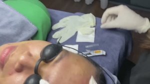 Кожа в сальных нитях и черных точках — смотрим чистку