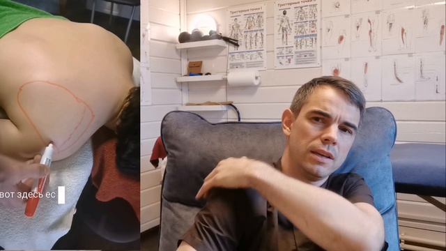 Про боль в плече