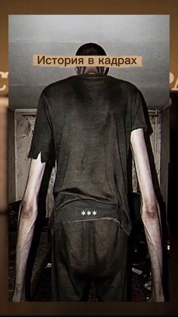 аномалия №139