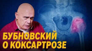 Метод Доктора Бубновского при КОКСАРТРОЗЕ- заболевание тазобедренного сустава