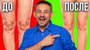 ПРИСЕДАНИЯ НЕ РАБОТАЮТ: как убрать дряблость коленей правильно