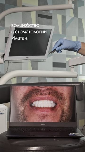 Результат одномоментной имплантации зубов с немедленной нагрузкой 🔝
