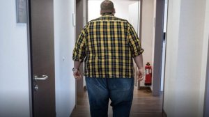 Россияне с ожирением смогут получить бесплатную хирургическую помощь по ОМС