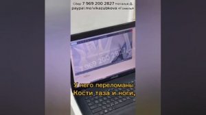 Бездомного мальчика сбила машина . Сбила и уехала😡. И он так и лежал на дороге РАНЕНЫЙ.