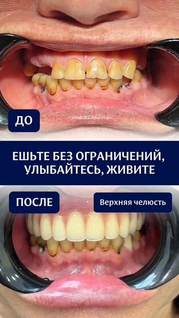 Кейс пациента