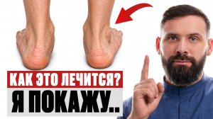 Трансформация стоп: от плоской до здоровой за 30 дней