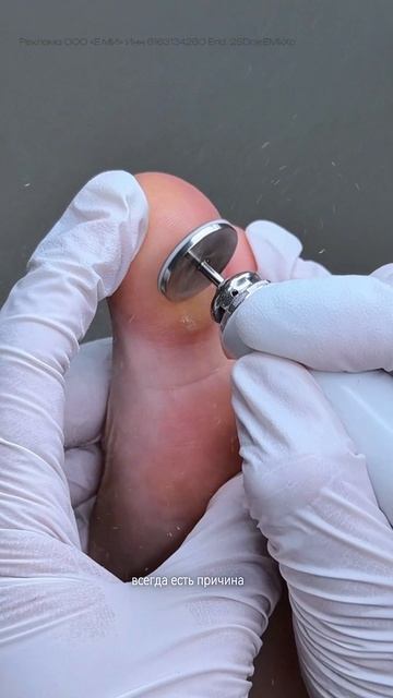 С какого возраста можно делать педикюр подросткам? 🤔 А вы смотрите на обувь своих детей?🙈