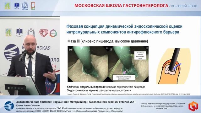 Куваев Роман Олегович Эндоскопические признаки нарушенной моторики при заболеваниях верхних отделов