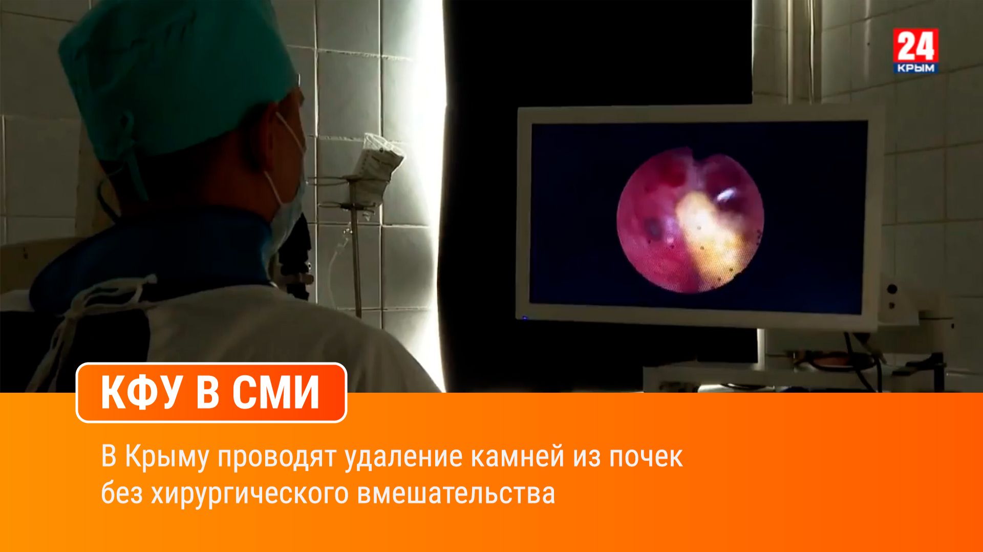 В Крыму проводят удаление камней из почек без хирургического вмешательства