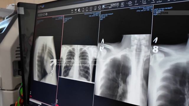 100 лет исполнилось областной туберкулезной больнице № 2