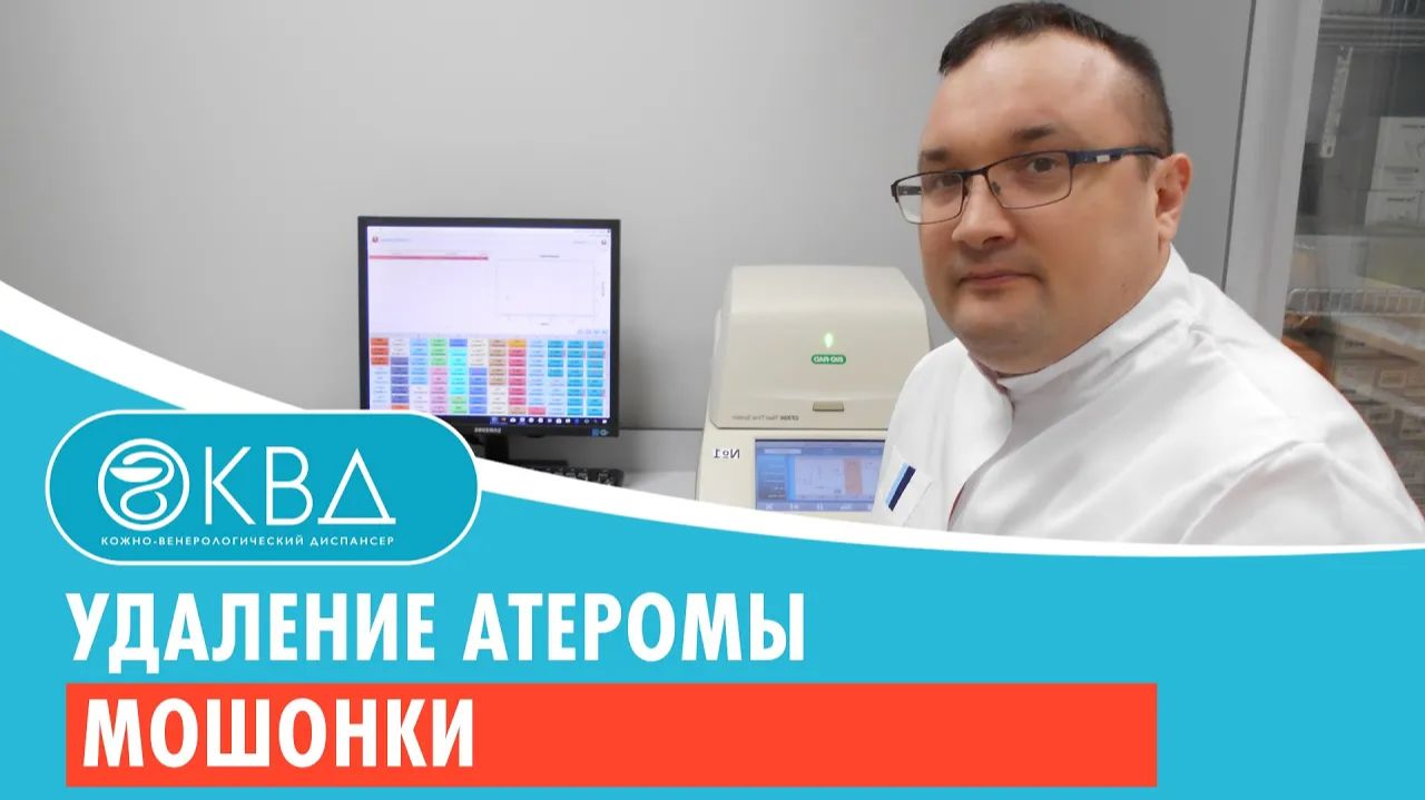 👦 Удаление атеромы мошонки. Клинический случай №172