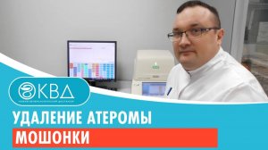 👦 Удаление атеромы мошонки. Клинический случай №172