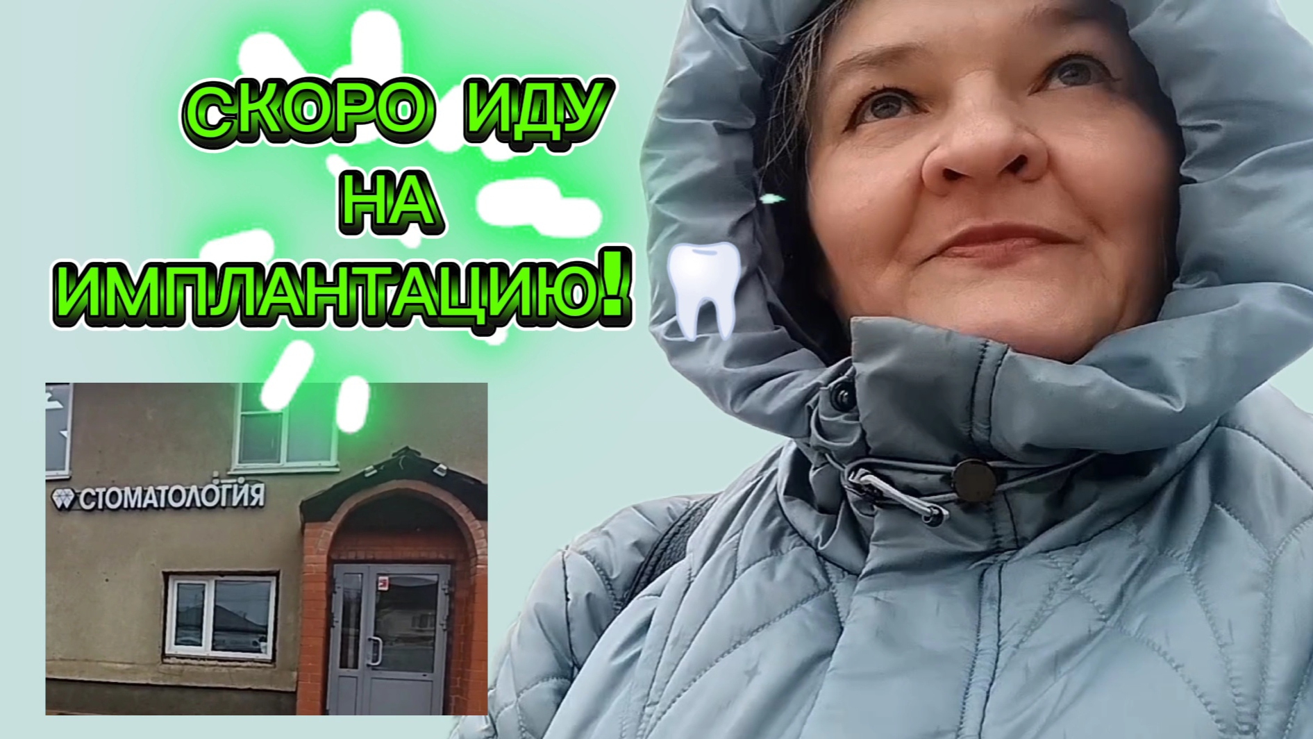 Имплантация зубов: мой следующий шаг. Осталось выбрать дату и узнать про слепок.