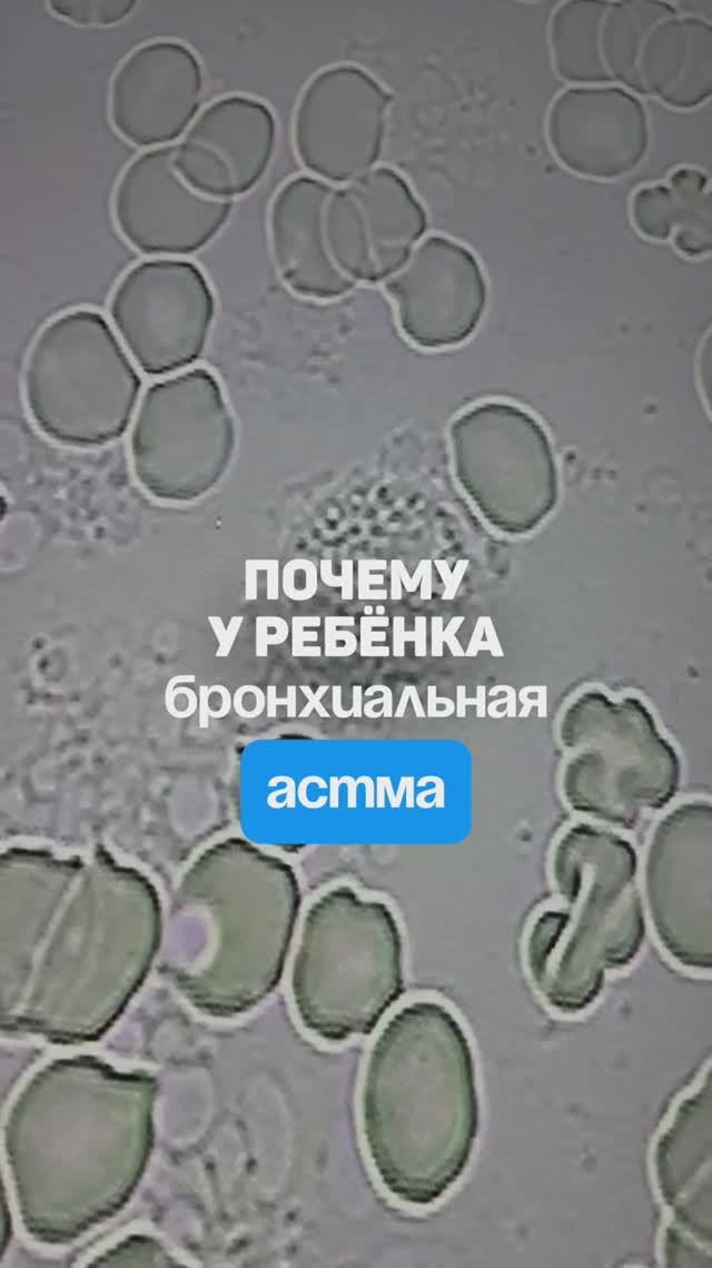 Причина появления бронхиальной астмы у ребенка. Семейный доктор Алена Братишко