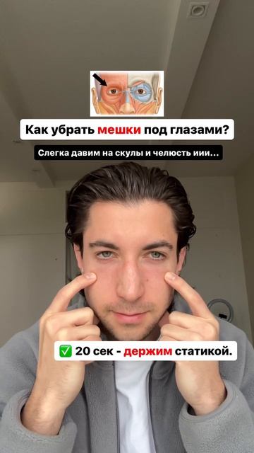 КАК УБРАТЬ МЕШКИ ПОД ГЛАЗАМИ!