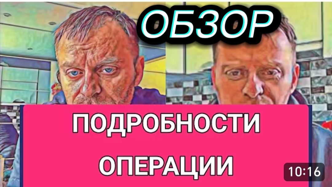 САМВЕЛ АДАМЯН, ОБЗОР ОТ ОЛЬГИ, ПОДРОБНОСТИ ОПЕРАЦИИ, ФОТО *ОПЫ НА ВЕСЬ ТИКТОК..