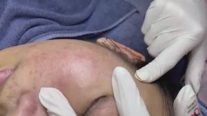 106 • Acne collection • АСМР • Relax Spa