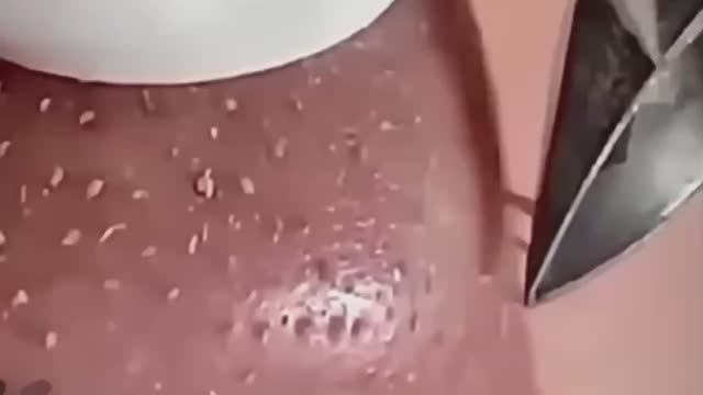 #299 Чистка лица от угрей и акне. Выдавливание прыщей. Удаление черных точек и комедонов