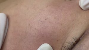 107 • Acne collection • АСМР • Relax Spa