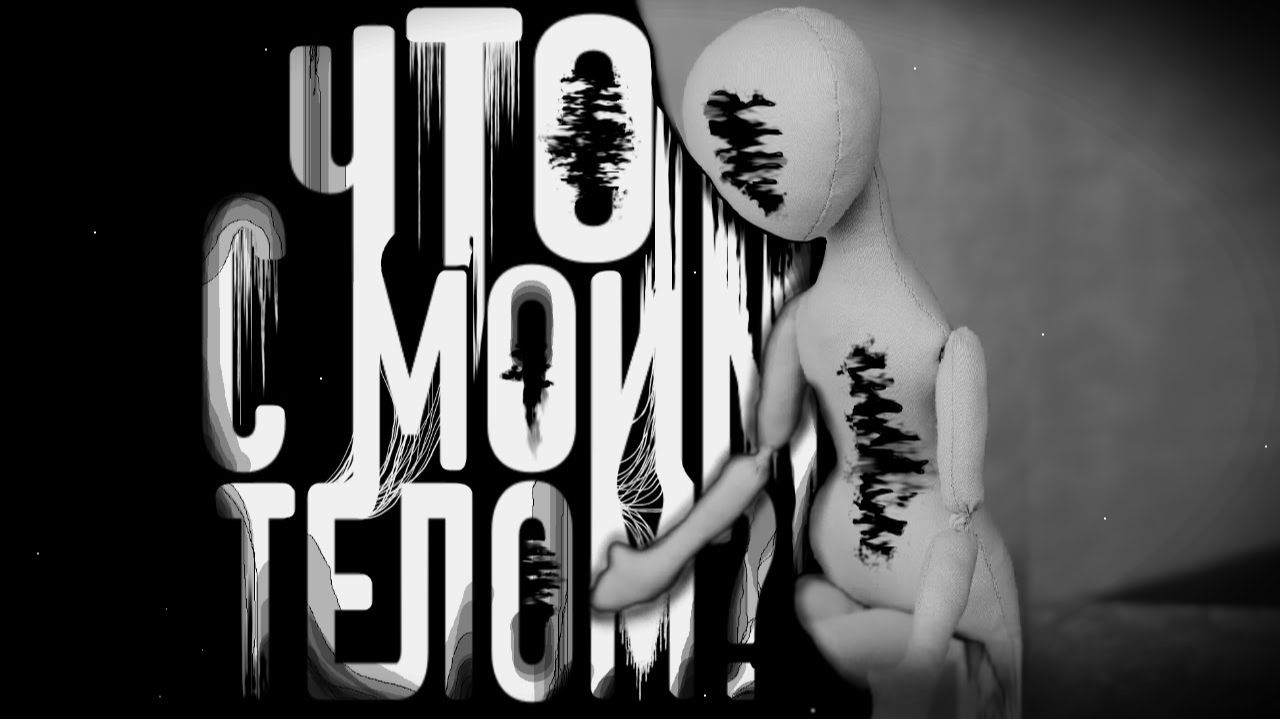 Истории из жизни | Что с моим телом? | Аудио рассказ| Слушать истории