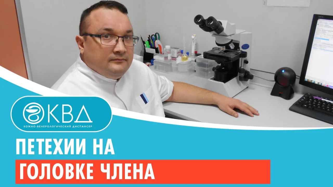 😐 Петехии на головке члена. Клинический случай №187