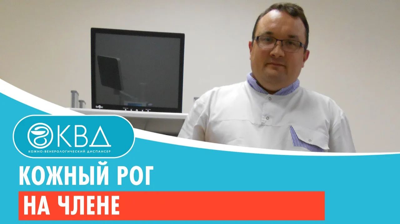 😐 Кожный рог на члене. Клинический случай №180
