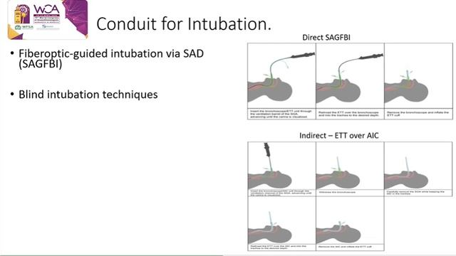 L.01.04 - Supraglottic Airways !