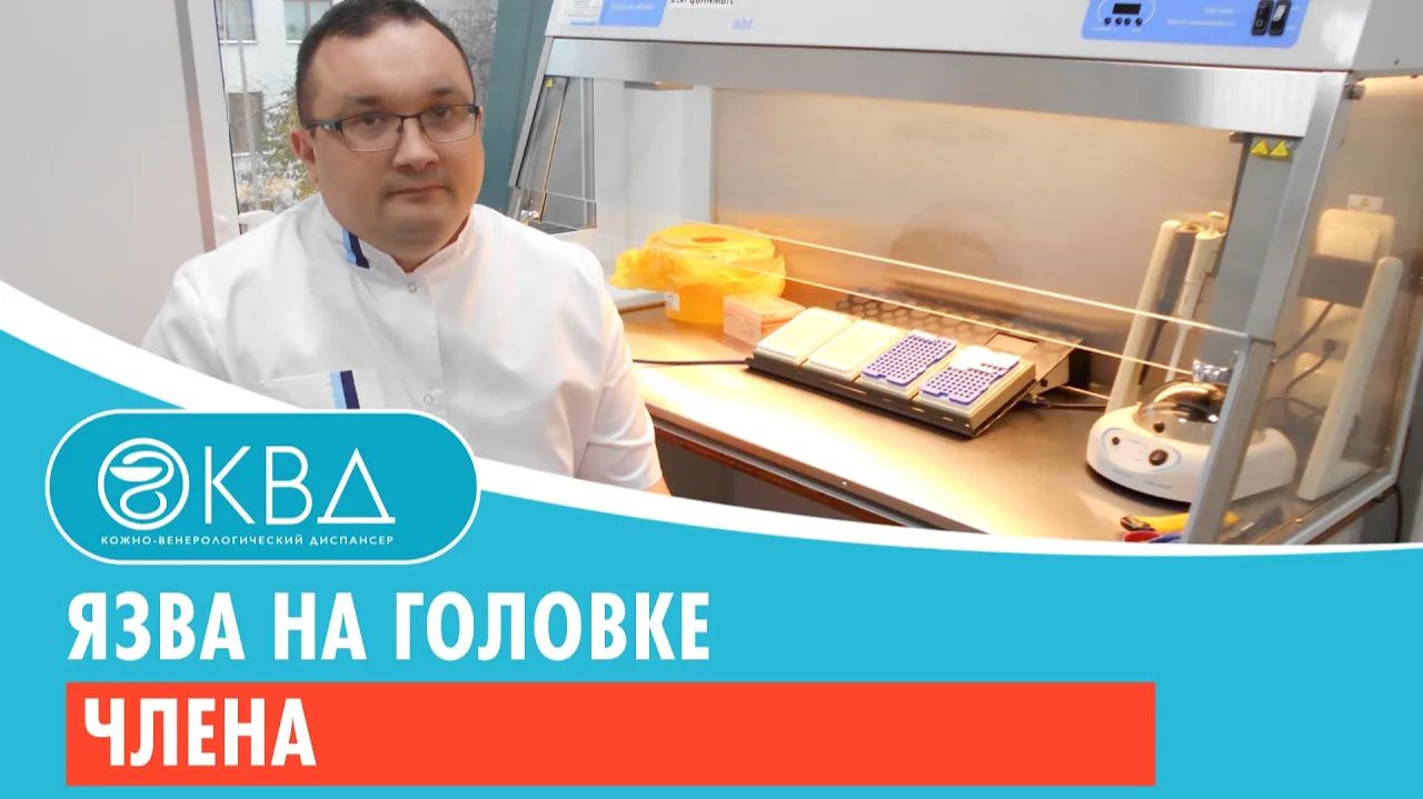 Язва на головке члена. Клинический случай №143 смотреть онлайн
