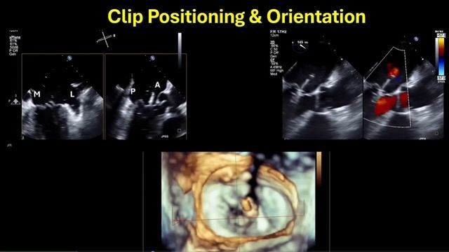 L.04.02 - The Changing Face Of Cardiac Anaesthesia !