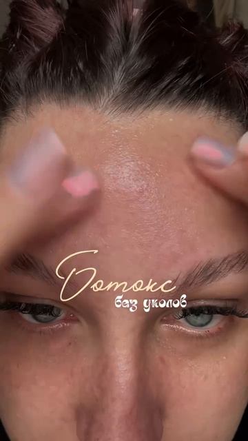 Ботокс без уколов? 😳   Да, это реально — если начать вовремя.