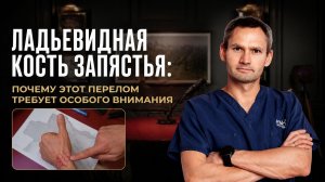 Перелом ладьевидной кости: диагностика, лечение и современные методы восстановления