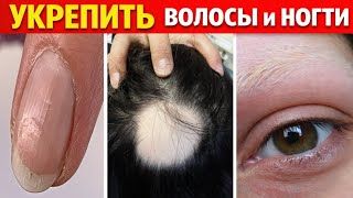 КАК УКРЕПИТЬ ВОЛОСЫ И НОГТИ. ВСЕ ПРИЧИНЫ И ЛЕЧЕНИЕ. смотреть онлайн