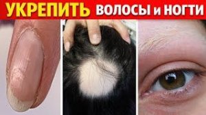 КАК УКРЕПИТЬ ВОЛОСЫ И НОГТИ. ВСЕ ПРИЧИНЫ И ЛЕЧЕНИЕ.