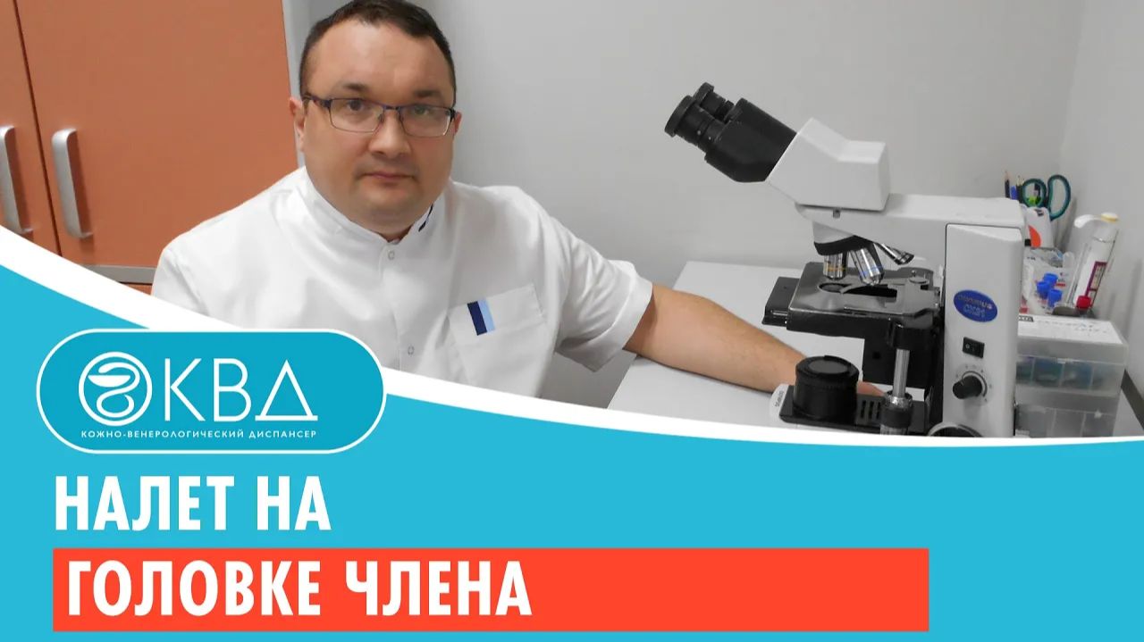 Налет на головке члена. Клинический случай №151