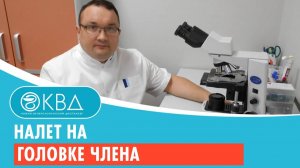 Налет на головке члена. Клинический случай №151