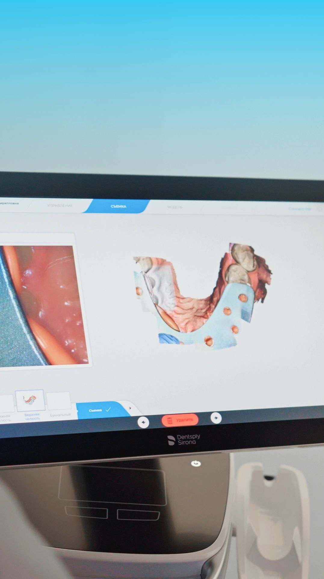 Выбили зуб - что делать?