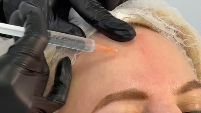 ИНЪЕКЦИОННАЯ КОСМЕТОЛОГИЯ