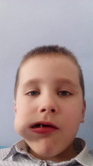 дурацкий капиталус