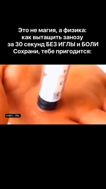 Как вытащить занозу
